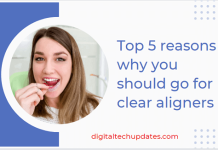 clear aligners