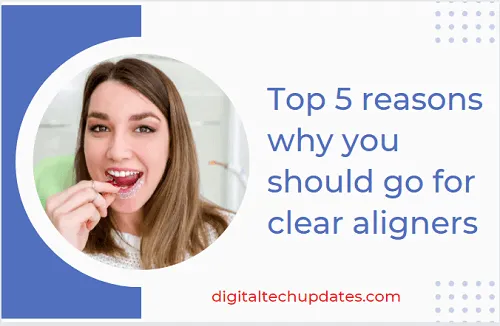 clear aligners